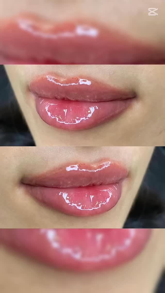 10% off all injectables until end of May!!! 
Nurse Raisa specializes in all injectables but had built her popularity over the past few years with her gorgeous lip work 🙌🏼🙌🏼🙌🏼
Come check her out Wednesdays at Selfish Beauty Lounge!
✨✨✨✨✨✨✨✨✨✨✨
#lips #lipinjection #vaughanlips #vaughaninjector #botox #chininjections #dysport #injectorvaughan #woodbridgelips #woodbridgeinjectables #lipswoodbridge #beauty #skincare #beautytips #skinrejuvenation