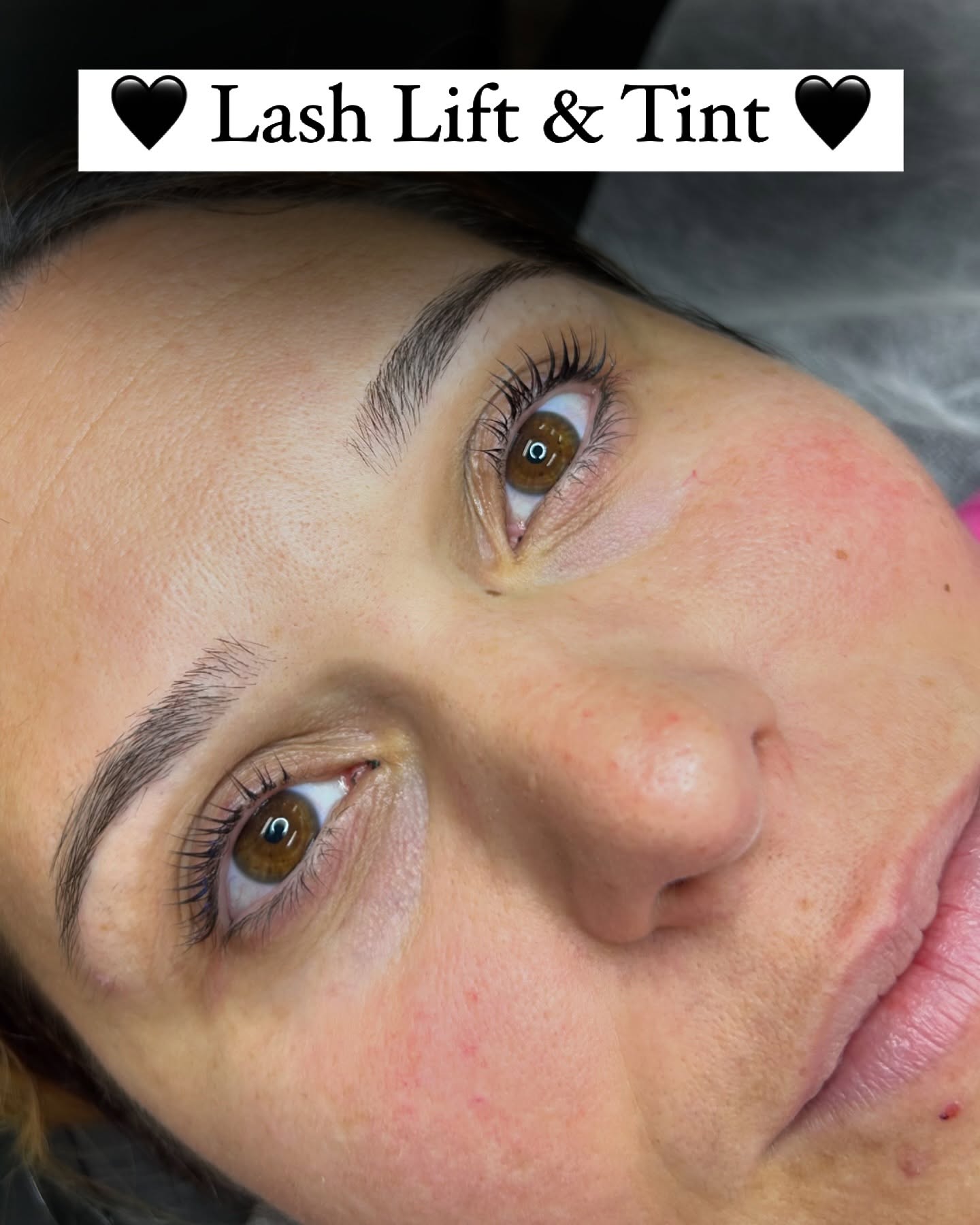 🤍🖤🤍🖤🤍
A lash lift is a beauty treatment that enhances the appearance of your natural eyelashes. It involves curling and lifting the lashes from the base, which gives them a longer, more defined look without the need for extensions or mascara. 
The process typically includes applying a specially formulated solution to the lashes, which helps to reshape and set them in their new position. The results can last several weeks, making it a popular choice for those looking to enhance their eyes with minimal maintenance. It’s a great way to achieve a more awake and youthful appearance!
Time: 1 hour 
Cost: $100 + $10 Tint
Book Online 🖤
#lashes #lashesvaughan #lasheswoodbridge #lashlift #lashextensions #brows #browlamination #aerolase #skincare #acne #skinrejuvenation #hairremoval #threading #lipfiller #botox #dysport