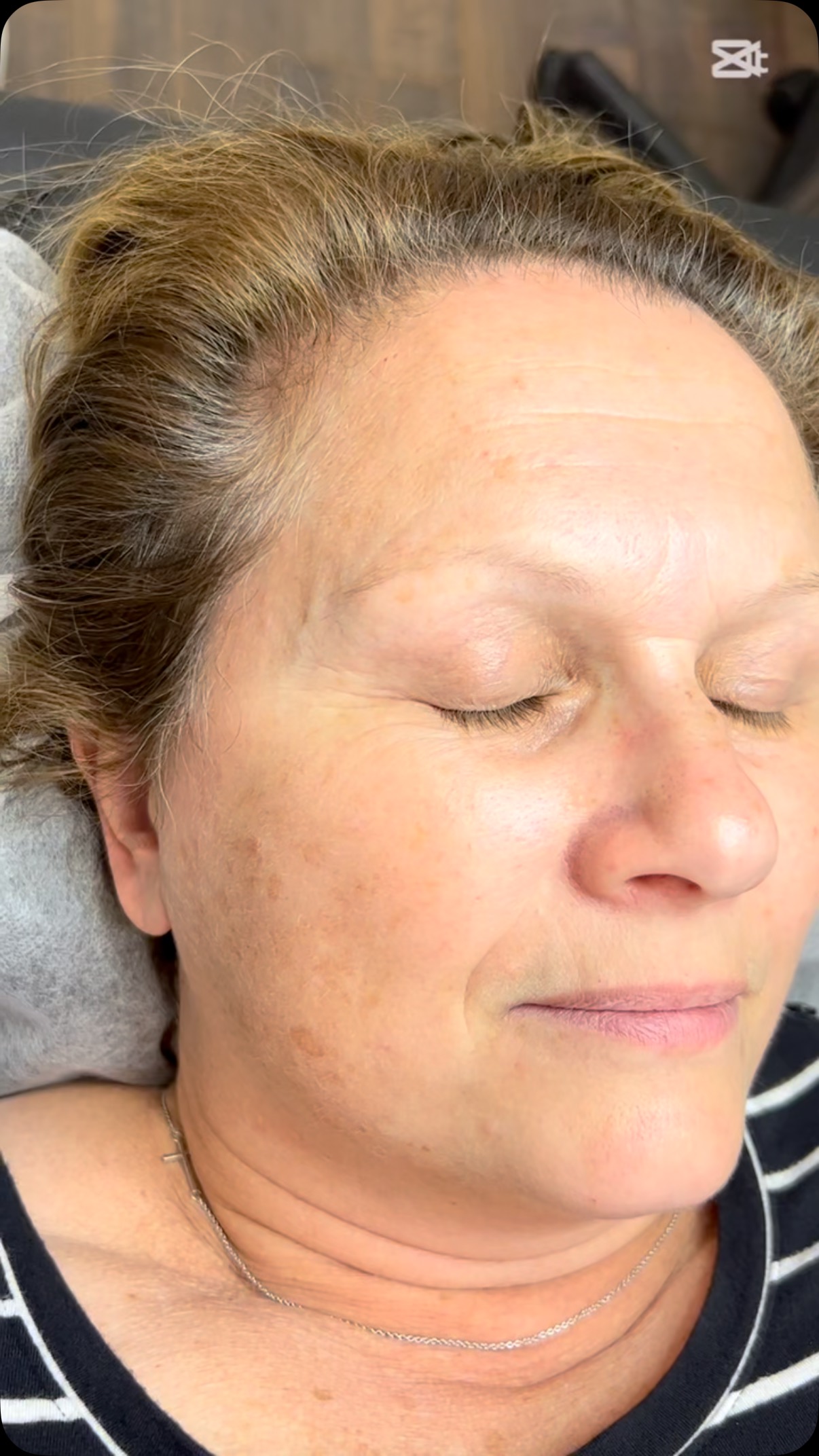 Spring makeovers are now in full effect! 🌺🌺🌺
Come in for your free consultation and so we can discover what treatment is best for you! 
Don’t miss out on any monthly promotions 🤍🤍
#microbladingvaughan #aerolase #microblading #microbladingwoodbridge #beauty #skincare #skincare #beautytips #skinrejuvenation #eyebrows #brows