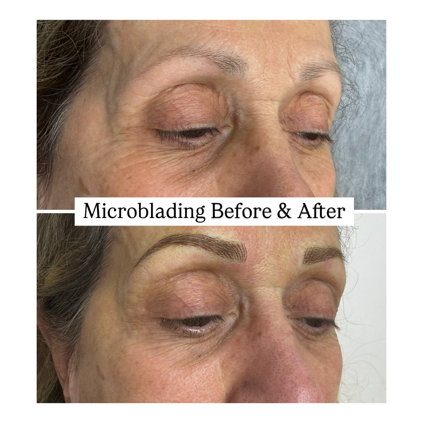 Obsessed with this eyebrow transformation! 
This treatment completely gives this client a lift and boost to create a youthful appearance ✨ 
If you’re having thoughts about doing this treatment but worried that it will not look natural, Selfish is the place to go! We specialize in natural looking microblading that suits everyone 🤍
Book your free consultation 🫶
Call us at 905-850-5899 or book online though our link 
#brows #microbladingvaughan #microbladingtoronto #eyebrowsvaughan #skincare #beautytips #vaughanbeauty #torontobeauty #richmondhillbeauty #aerolase #microbladingtraining