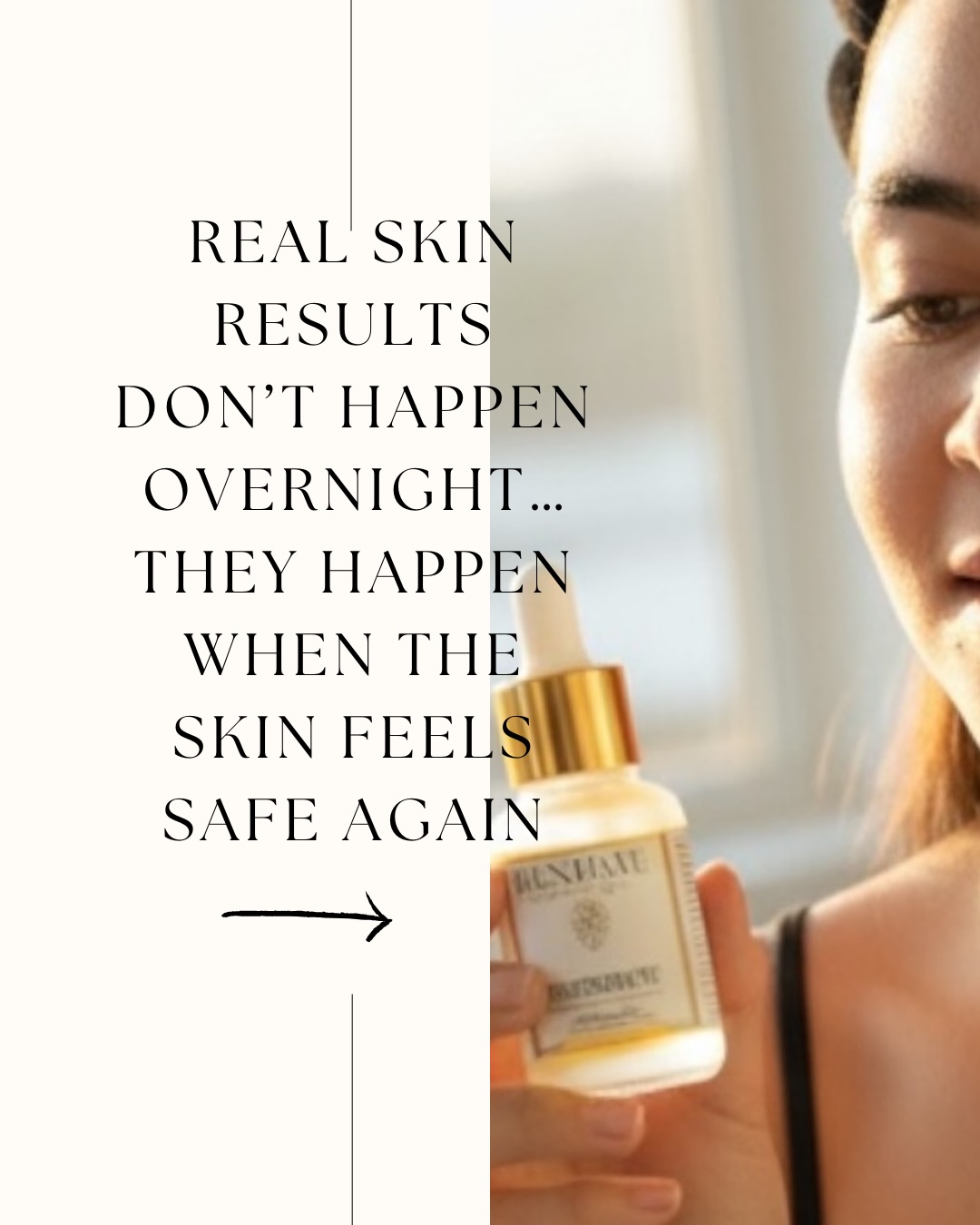 Real skin change doesn’t happen fast — it happens when the skin finally feels safe.
When someone tells us they’ve used our products for over a year, that’s not about hype.
That’s about trust.
About barrier repair.
About giving the skin what it needs to function again.
At Results by Nature®, we don’t believe in forcing results.
We believe in supporting the systems that create them.
If your skin feels reactive, unpredictable, or exhausted — it may not need more stimulation.
It may need less pressure and better support.
Save this for when your skin asks for calm.
💬 DM “SKIN” for personalized guidance.
With love & light,
Samantha & Kelly
Results by Nature®
#HormoneSafeSkincare
#BarrierSupport
#ReactiveSkinCare
#BioIntegrativeSkincare
#SkinBarrierHealth